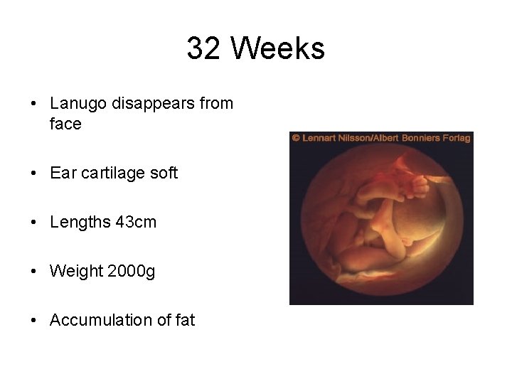 32 Weeks • Lanugo disappears from face • Ear cartilage soft • Lengths 43