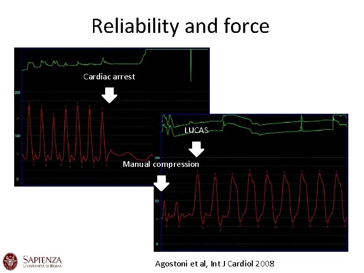 Reliability and force Cardiac arrest LUCAS Manual compression Agostoni et al, Int J Cardiol Reliability and force Cardiac arrest LUCAS Manual compression Agostoni et al, Int J Cardiol