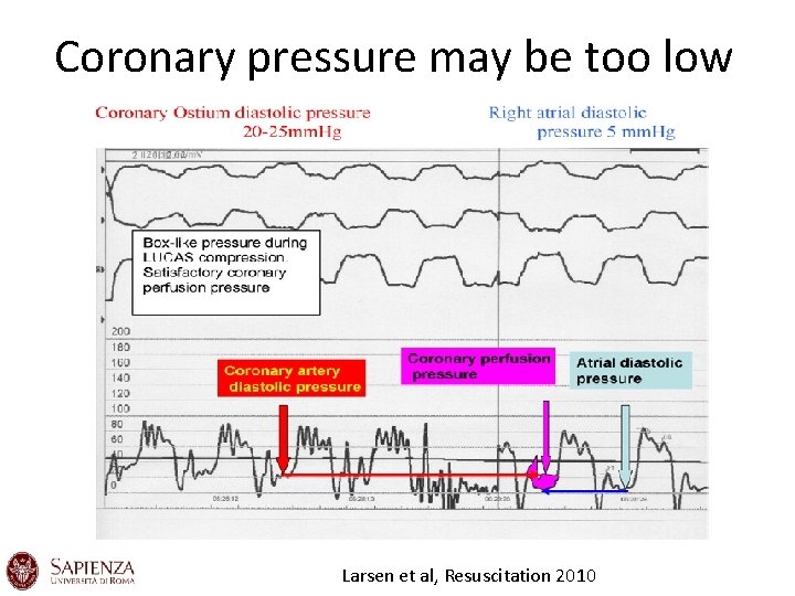 Coronary pressure may be too low Larsen et al, Resuscitation 2010 Coronary pressure may be too low Larsen et al, Resuscitation 2010