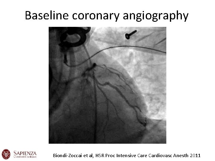 Baseline coronary angiography Biondi-Zoccai et al, HSR Proc Intensive Cardiovasc Anesth 2011 Baseline coronary angiography Biondi-Zoccai et al, HSR Proc Intensive Cardiovasc Anesth 2011