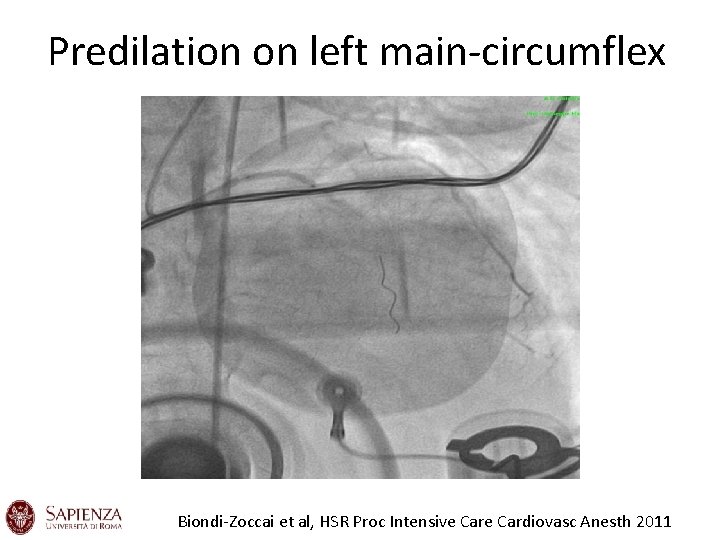 Predilation on left main-circumflex Biondi-Zoccai et al, HSR Proc Intensive Cardiovasc Anesth 2011 Predilation on left main-circumflex Biondi-Zoccai et al, HSR Proc Intensive Cardiovasc Anesth 2011