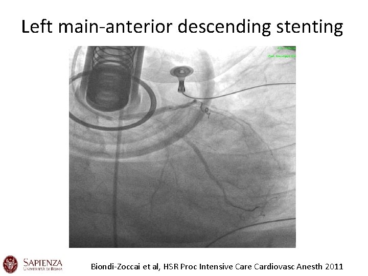 Left main-anterior descending stenting Biondi-Zoccai et al, HSR Proc Intensive Cardiovasc Anesth 2011 Left main-anterior descending stenting Biondi-Zoccai et al, HSR Proc Intensive Cardiovasc Anesth 2011