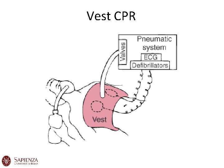 Vest CPR Vest CPR