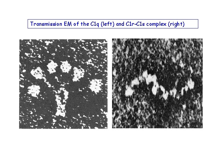 Transmission EM of the C 1 q (left) and C 1 r-C 1 s