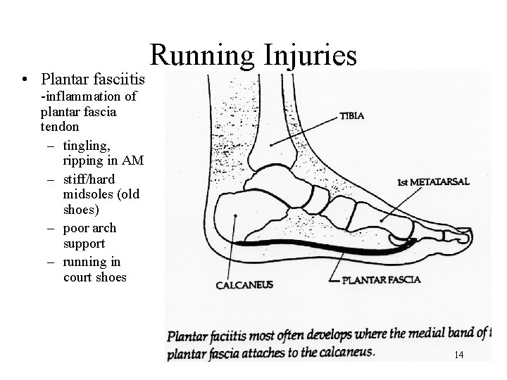 • Plantar fasciitis Running Injuries -inflammation of plantar fascia tendon – tingling, ripping • Plantar fasciitis Running Injuries -inflammation of plantar fascia tendon – tingling, ripping