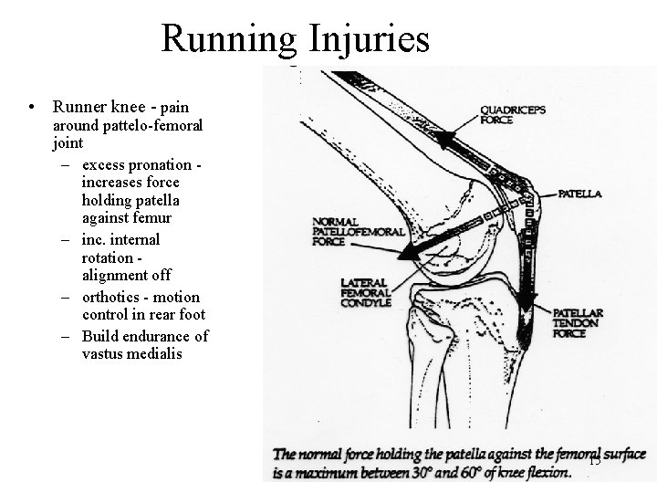 Running Injuries • Runner knee - pain around pattelo-femoral joint – excess pronation increases Running Injuries • Runner knee - pain around pattelo-femoral joint – excess pronation increases