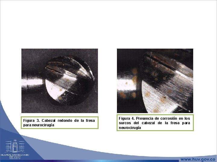 Figura 3. Cabezal redondo de la fresa para neurocirugía Figura 4. Presencia de corrosión