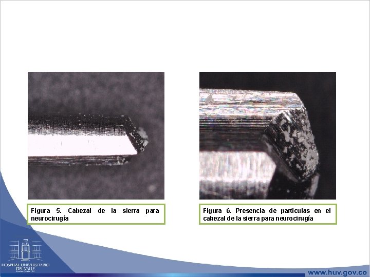 Figura 5. Cabezal neurocirugía de la sierra para Figura 6. Presencia de partículas en