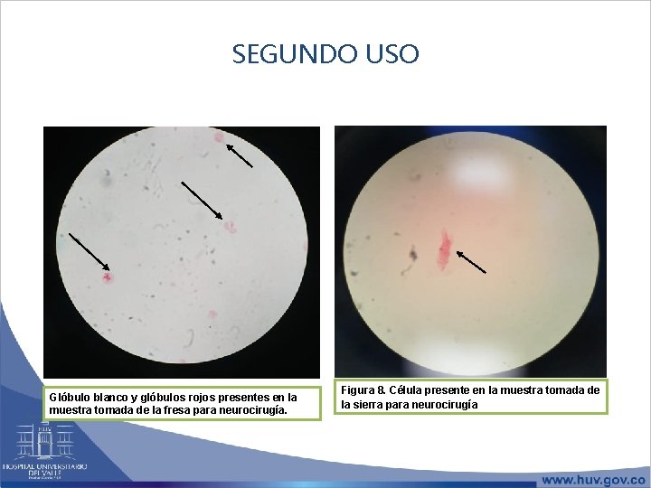 SEGUNDO USO Glóbulo blanco y glóbulos rojos presentes en la muestra tomada de la