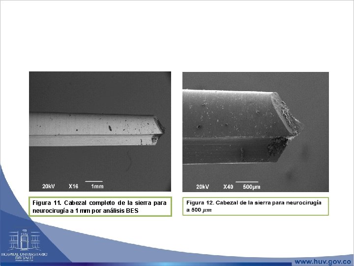 Figura 11. Cabezal completo de la sierra para neurocirugía a 1 mm por análisis