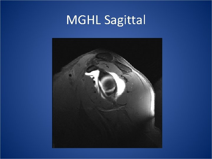 MGHL Sagittal 