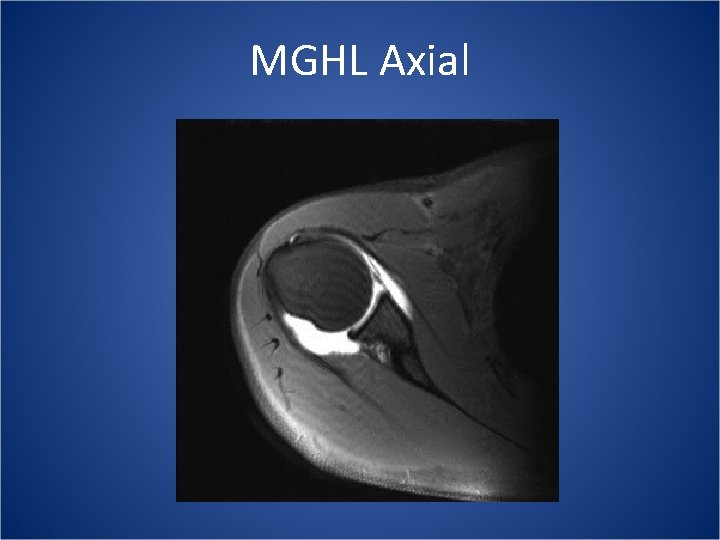 MGHL Axial 