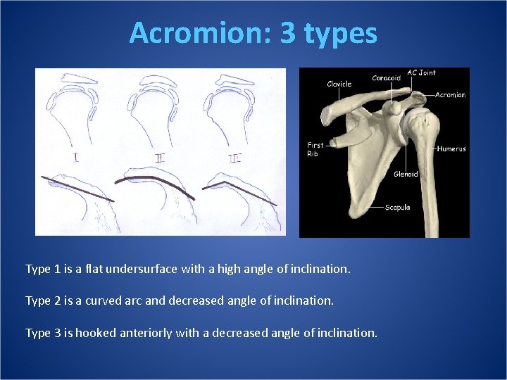 Acromion: 3 types Type 1 is a flat undersurface with a high angle of