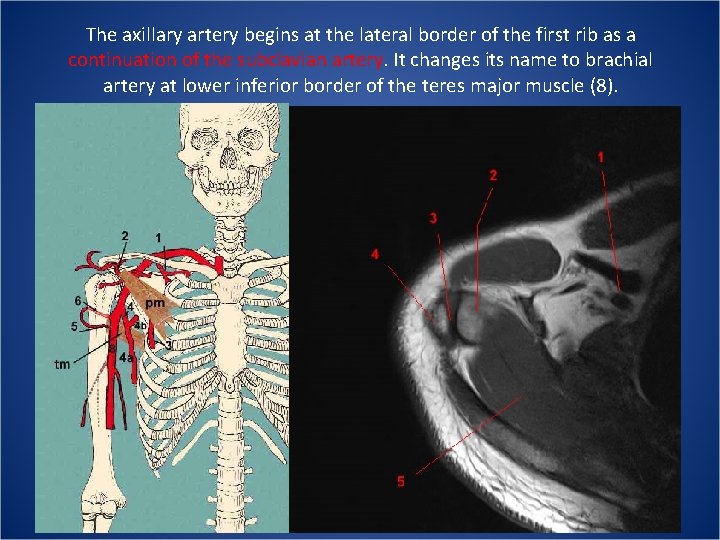 The axillary artery begins at the lateral border of the first rib as a