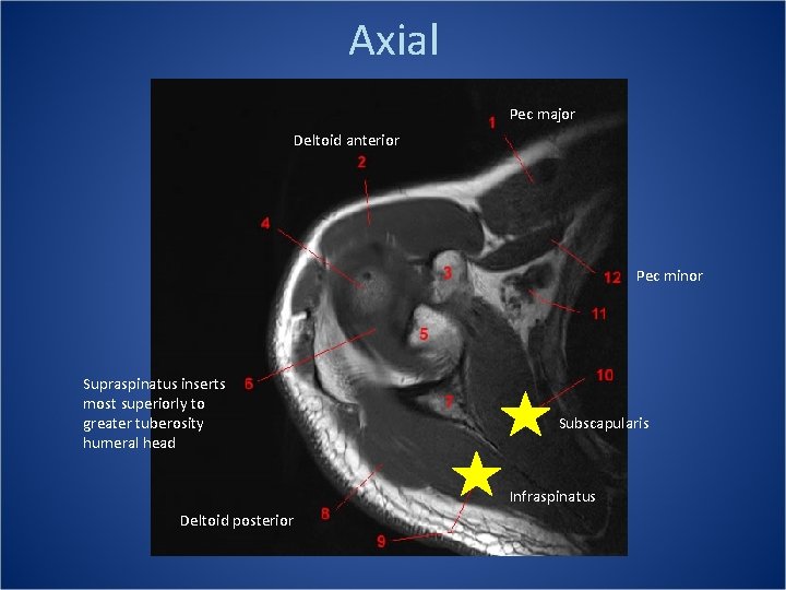 Axial Pec major Deltoid anterior Pec minor Supraspinatus inserts most superiorly to greater tuberosity