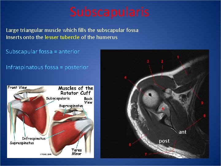 Subscapularis Large triangular muscle which fills the subscapular fossa Inserts onto the lesser tubercle