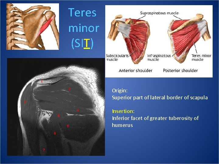 Teres minor (SIT) Origin: Superior part of lateral border of scapula Insertion: Inferior facet