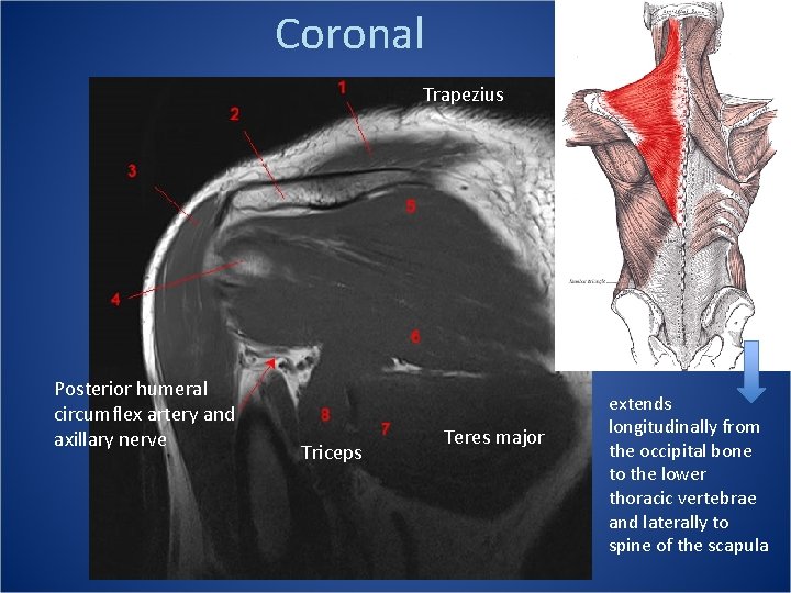 Coronal Trapezius Posterior humeral circumflex artery and axillary nerve Triceps Teres major extends longitudinally
