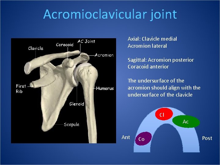 Acromioclavicular joint Axial: Clavicle medial Acromion lateral Sagittal: Acromion posterior Coracoid anterior The undersurface