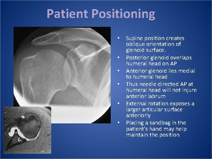 Patient Positioning • Supine position creates oblique orientation of glenoid surface. • Posterior glenoid