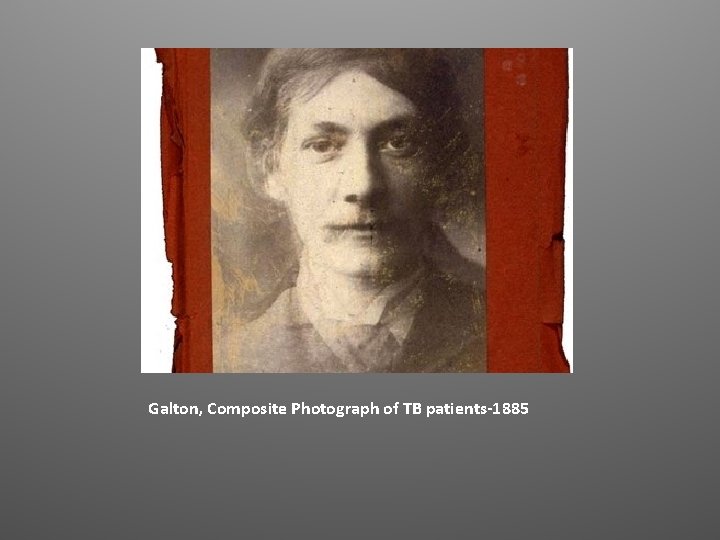 Galton, Composite Photograph of TB patients-1885 