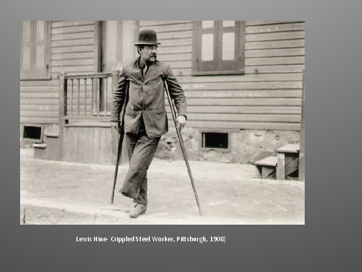 Lewis Hine- Crippled Steel Worker, Pittsburgh, 1908) 