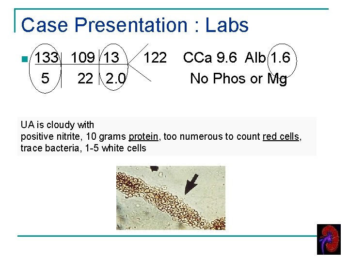 Case Presentation : Labs n 133 109 13 5 22 2. 0 122 CCa