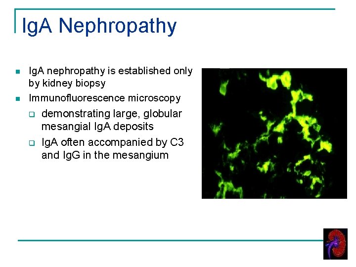Ig. A Nephropathy n n Ig. A nephropathy is established only by kidney biopsy