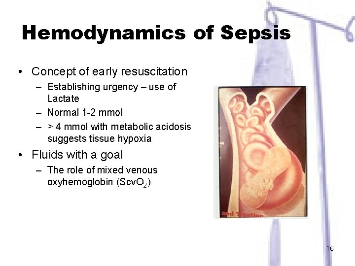 Hemodynamics of Sepsis • Concept of early resuscitation – Establishing urgency – use of