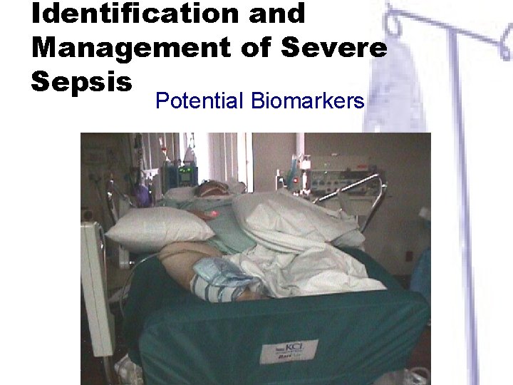 Identification and Management of Severe Sepsis Potential Biomarkers 
