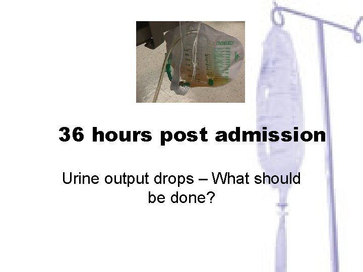 36 hours post admission Urine output drops – What should be done? 