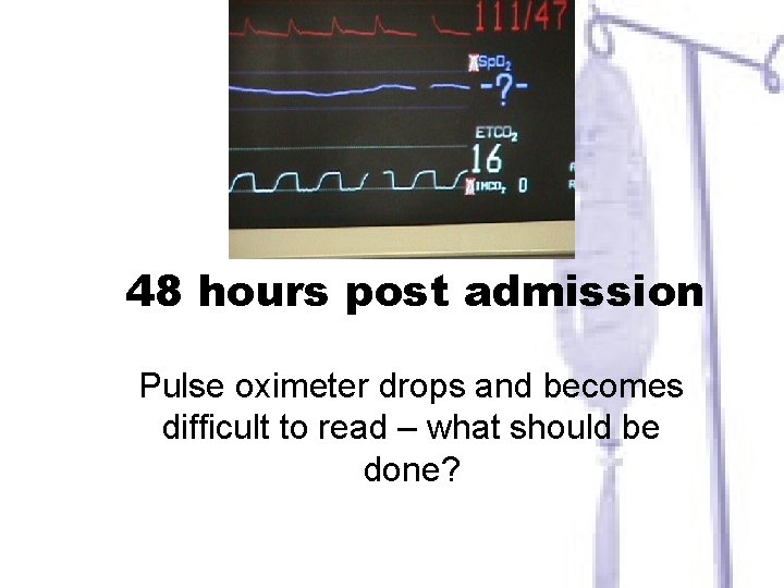 48 hours post admission Pulse oximeter drops and becomes difficult to read – what