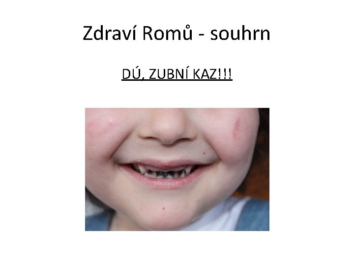 Zdraví Romů - souhrn DÚ, ZUBNÍ KAZ!!! 