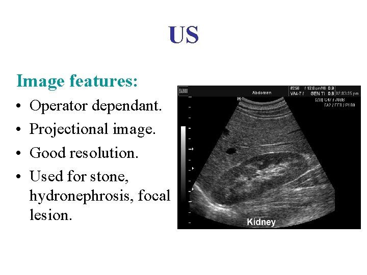 US Image features: • • Operator dependant. Projectional image. Good resolution. Used for stone,