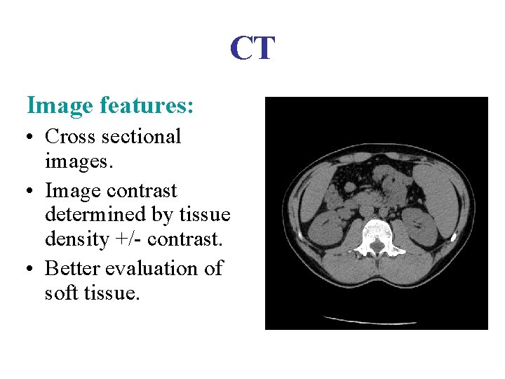 CT Image features: • Cross sectional images. • Image contrast determined by tissue density