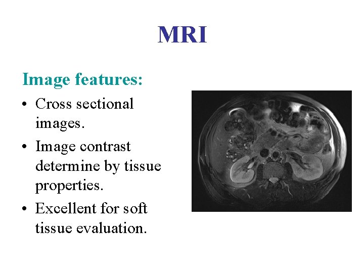 MRI Image features: • Cross sectional images. • Image contrast determine by tissue properties.