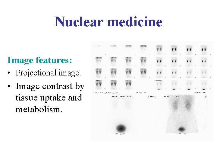 Nuclear medicine Image features: • Projectional image. • Image contrast by tissue uptake and Nuclear medicine Image features: • Projectional image. • Image contrast by tissue uptake and