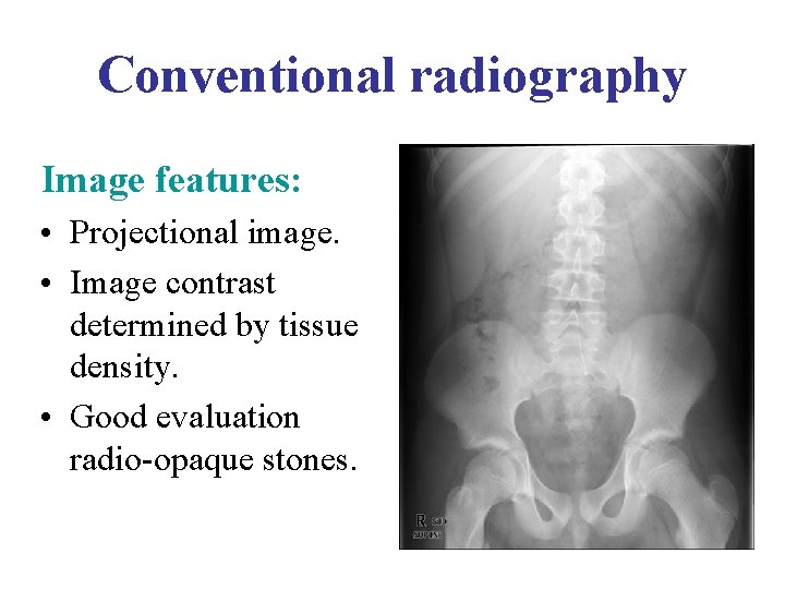 Conventional radiography Image features: • Projectional image. • Image contrast determined by tissue density.