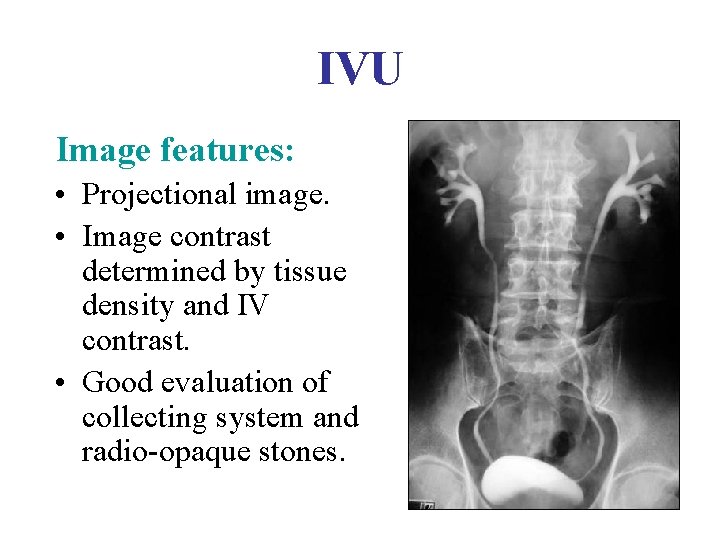IVU Image features: • Projectional image. • Image contrast determined by tissue density and IVU Image features: • Projectional image. • Image contrast determined by tissue density and