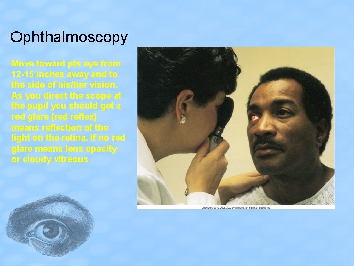 Ophthalmoscopy Move toward pts eye from 12 -15 inches away and to the side
