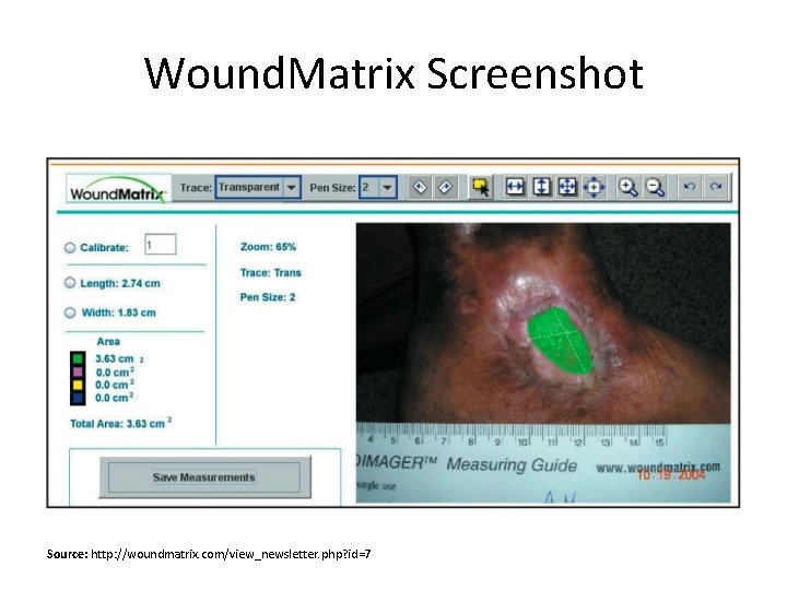 Wound. Matrix Screenshot Source: http: //woundmatrix. com/view_newsletter. php? id=7 
