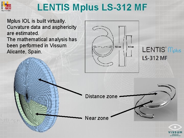 LENTIS Mplus LS-312 MF Mplus IOL is built virtually. Curvature data and asphericity are