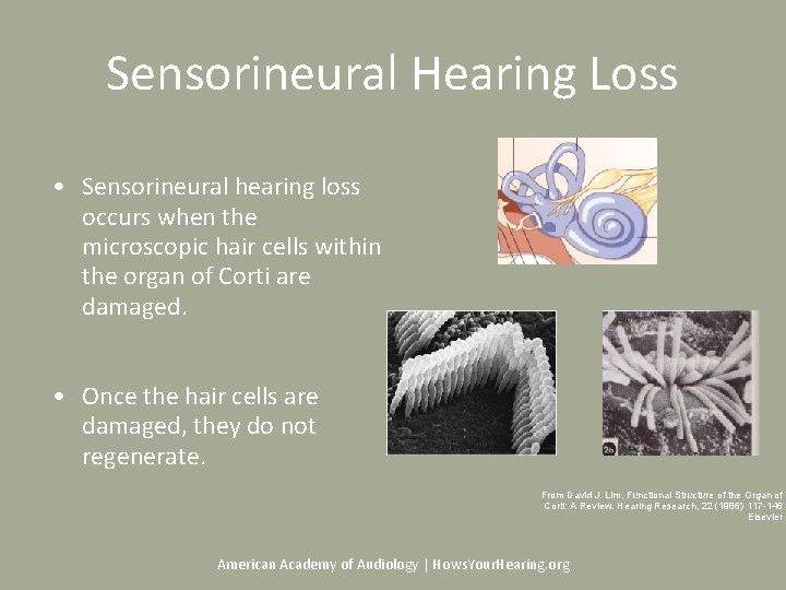 Sensorineural Hearing Loss • Sensorineural hearing loss occurs when the microscopic hair cells within