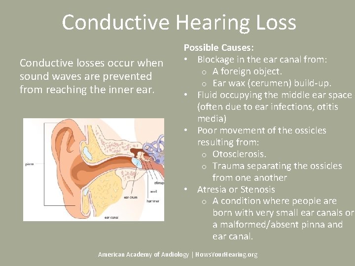 Conductive Hearing Loss Conductive losses occur when sound waves are prevented from reaching the