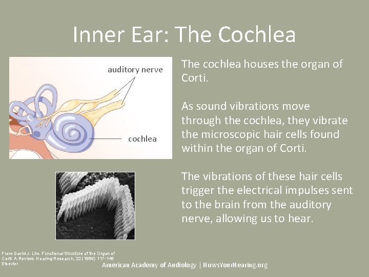 Inner Ear: The Cochlea auditory nerve cochlea The cochlea houses the organ of Corti.