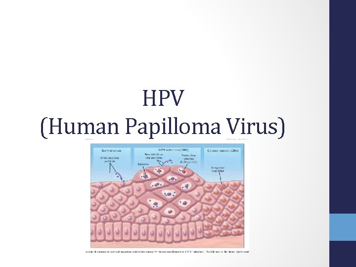 HPV (Human Papilloma Virus) 