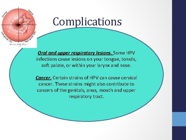 Complications Oral and upper respiratory lesions. Some HPV infections cause lesions on your tongue,