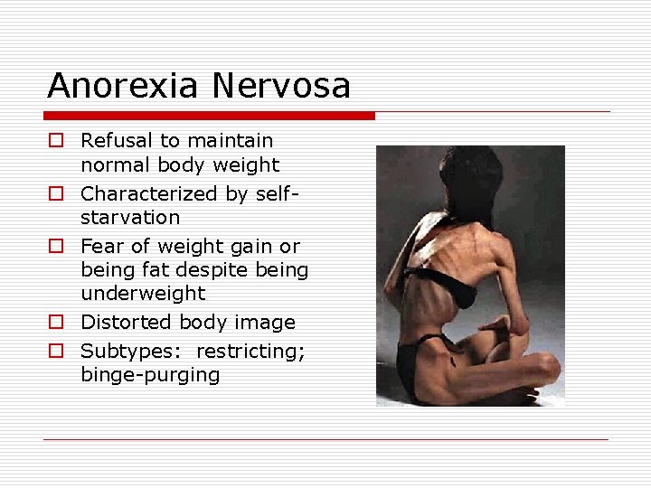 Anorexia Nervosa o Refusal to maintain normal body weight o Characterized by selfstarvation o