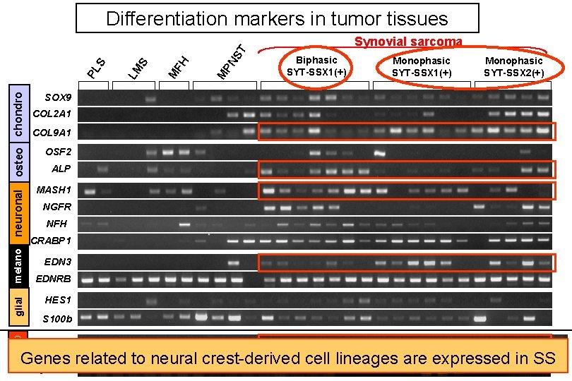 GeneExpression Pattern and Differentiation Potential of Synovial Sarcoma