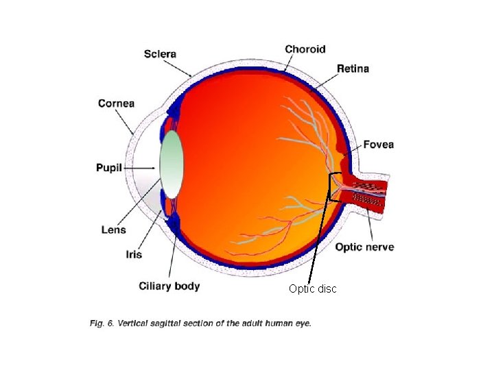 Optic disc 